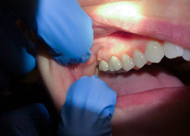 Best Broken or Cracked Tooth Emergency Dentist in Maxwell, CA