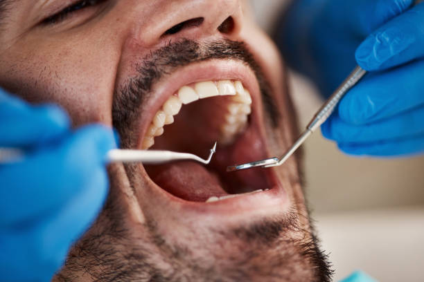 Best Urgent Dental Care for Toothache in Maxwell, CA