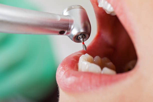 Best Pediatric Emergency Dentist in Maxwell, CA